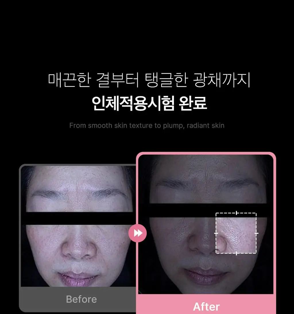 [청담샵화잘먹] 메디큐브 PDRN 핑크 콜라겐 글로우 젤리 미스트 100ml 더블기획(+미스트 공병키링) 상세페이지 52